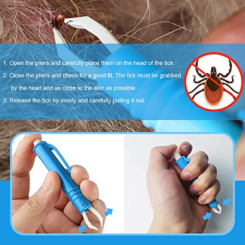 Niserelesa Pinzas para Garrapatas,Gancho para Garrapatas,Removedor De Garrapatas,Pinzas Antigarrapatas para Perros Y Gatos,3X Palanca De Garrapatas,1x Pinzas para Garrapatas,para Humanos,Perros,Niños